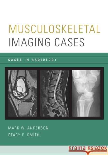 Musculoskeletal Imaging Cases Mark W. Anderson Stacy E. Smith 9780195394375 Oxford University Press, USA