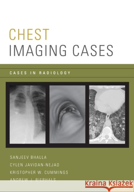 Chest Imaging Cases Sanjeev Bhalla Cylen Javidan-Nejad Kristopher W. Cummings 9780195394535 Oxford University Press, USA