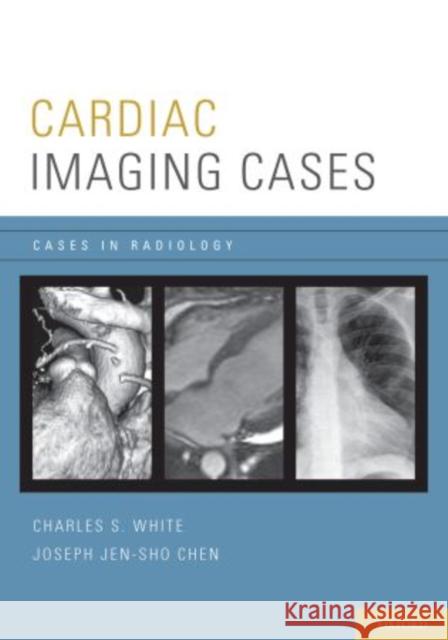 Cardiac Imaging Cases Charles White Joseph Chen 9780195395433