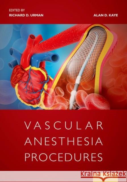 Vascular Anesthesia Procedures Richard Urman, MD (Associate Professor o Alan Kaye (Professor of Anesthesiology a  9780197506073 Oxford University Press Inc