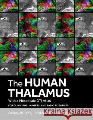 The Human Thalamus Lenz 9780197540916 Oxford University Press, USA