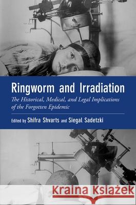 Ringworm and Irradiation: The Historical, Medical, and Legal Implications of the Forgotten Epidemic Shifra Shvarts (Professor Emerita within the Faculty of Health Sciences, Professor Emerita within the Faculty of Health  9780197568965 Oxford University Press Inc