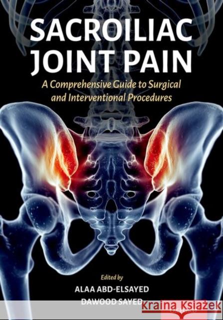 Sacroiliac Joint Pain: A Comprehensive Guide to Interventional and Surgical Procedures Alaa Abd-Elsayed Dawood Sayed 9780197607947