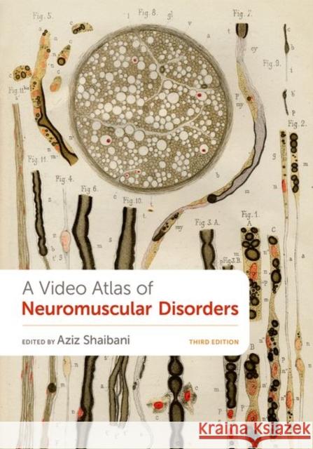 A Video Atlas of Neuromuscular Disorders Aziz Shaibani 9780197632581