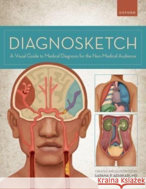 Diagnosketch: A Visual Guide to Medical Diagnosis for the Non-Medical Audience Adhikari, Sapana 9780197636954 Oxford University Press Inc