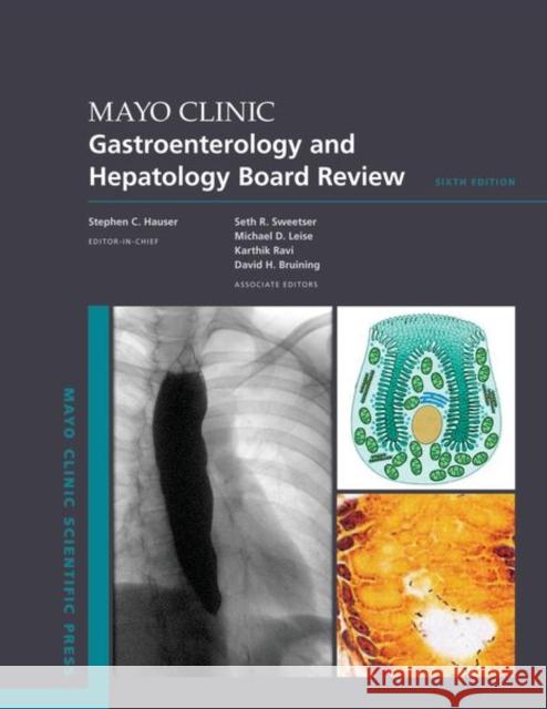 Mayo Clinic Gastroenterology and Hepatology Board Review  9780197679753 Oxford University Press Inc