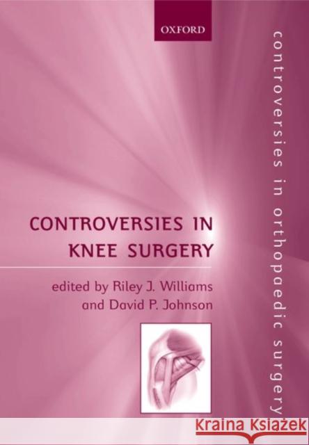 Controversies in Knee Surgery Riley J. Williams David P. Johnson Riley J. Williams 9780198520665 Oxford University Press, USA