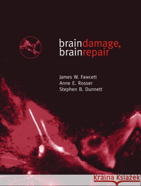 Brain Damage, Brain Repair James W. Fawcett Anne E. Rosser Stephen B. Dunnett 9780198523376 Oxford University Press, USA