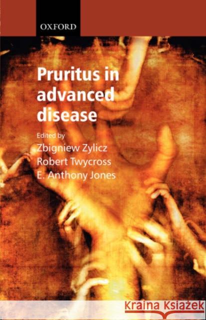 Pruritus in Advanced Disease Zbigniew Zylicz 9780198525103 OXFORD UNIVERSITY PRESS