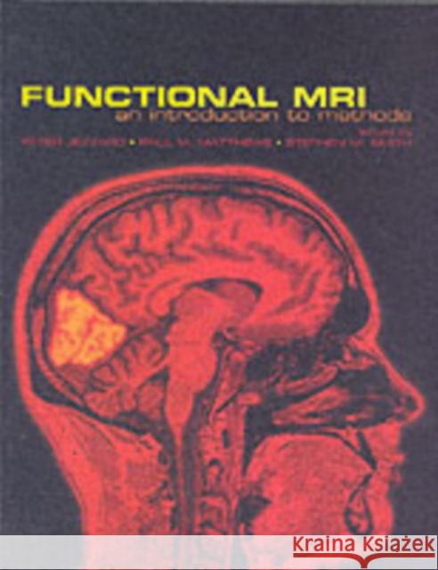 Functional Magnetic Resonance Imaging : An Introduction to Methods Peter Jezzard Paul M. Matthews Stephen M. Smith 9780198527732 Oxford University Press, USA