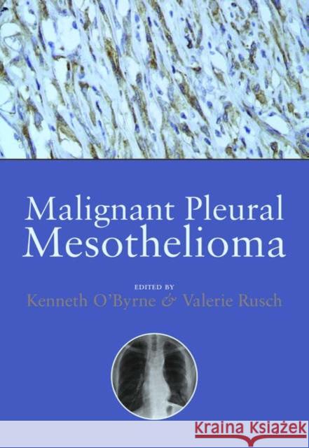 Malignant Pleural Mesothelioma Kenneth O'Byrne Valerie Rusch 9780198529309 Oxford University Press, USA