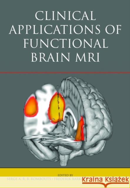 Clinical Applications of Functional Brain MRI Serge A. Rombouts Serge A. Rombouts Frederick Barkhof 9780198566298 Oxford University Press, USA
