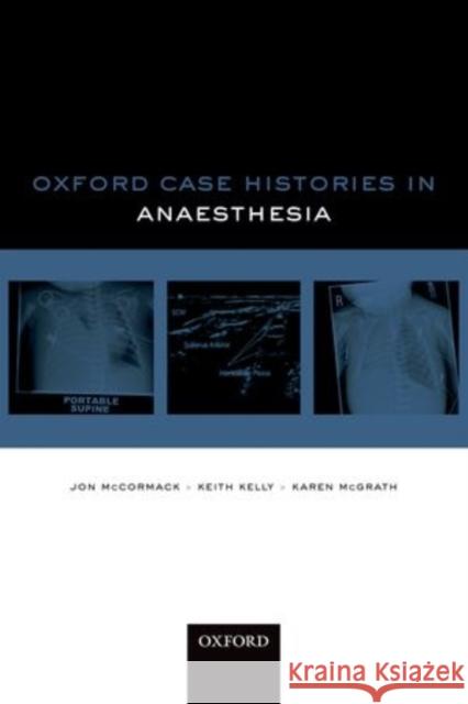 Oxford Case Histories: Anaesthesia John McCormack 9780198704867 OXFORD UNIVERSITY PRESS ACADEM