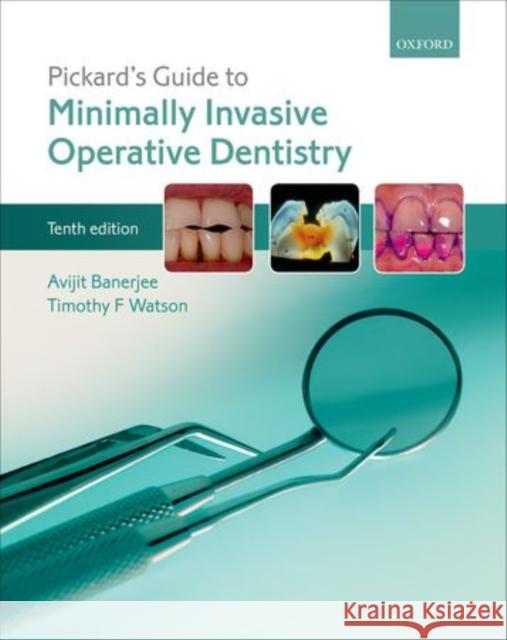 Pickard's Guide to Minimally Invasive Operative Dentistry Avit Banerjee 9780198712091 Oxford University Press