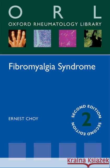 Fibromyalgia Syndrome Ernest Choy 9780198723233