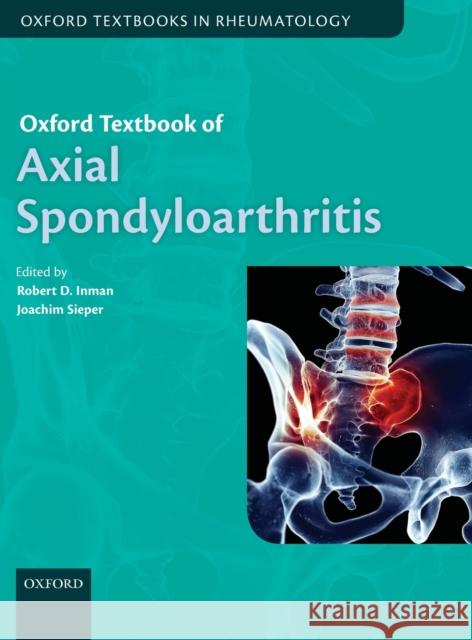 Oxford Textbook of Axial Spondyloarthritis Robert Inman Joachim Sieper 9780198734444 Oxford University Press, USA