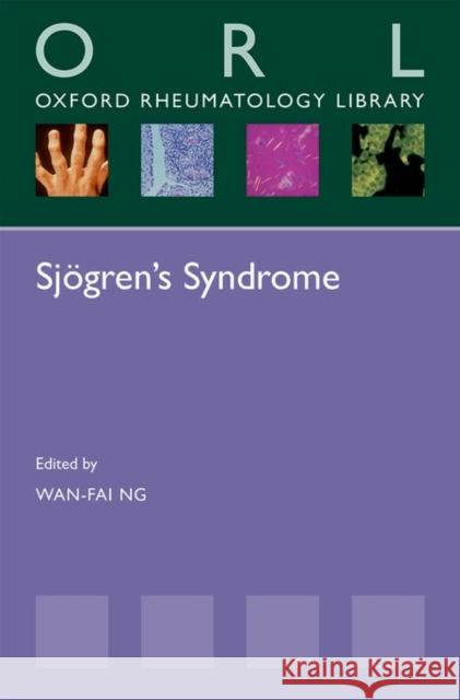 Sjogren's Syndrome Wan-Fai Ng 9780198736950 Oxford University Press, USA