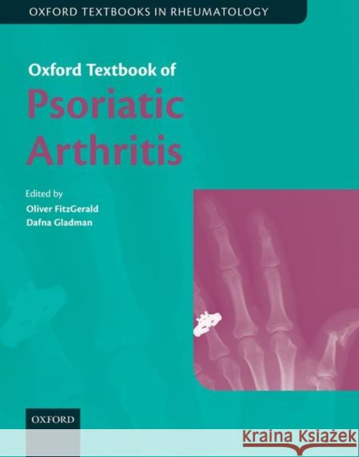 Oxford Textbook of Psoriatic Arthritis Oliver Fitzgerald Dafna Gladman 9780198737582 Oxford University Press, USA