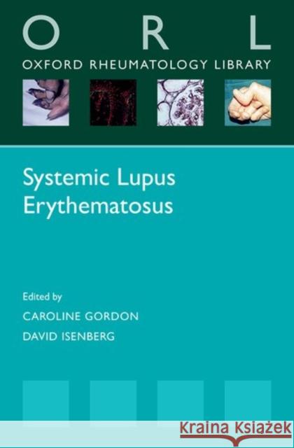 Systemic Lupus Erythematosus Caroline Gordon 9780198739180 OXFORD UNIVERSITY PRESS ACADEM