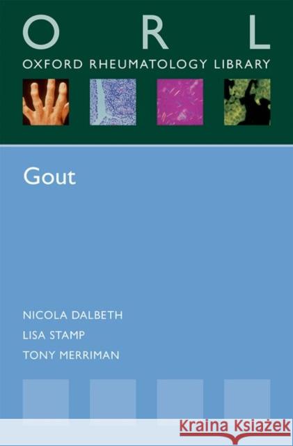 Gout Nicola Dalbeth Lisa Stamp Tony Merriman 9780198748311 Oxford University Press, USA