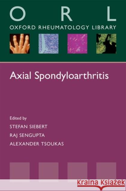 Axial Spondyloarthritis Stefan Siebert Raj Sengupta Alexander Tsoukas 9780198755296