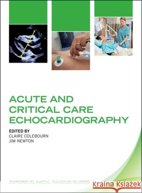 Acute and Critical Care Echocardiography Claire Colebourn Jim Newton 9780198757160 Oxford University Press, USA