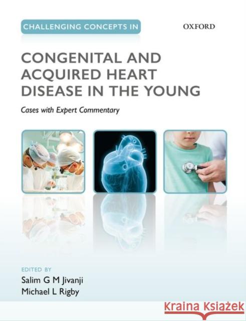 Challenging Concepts in Congenital and Acquired Heart Disease in the Young: A Case-Based Approach with Expert Commentary Jivanji, Salim 9780198759447 Oxford University Press