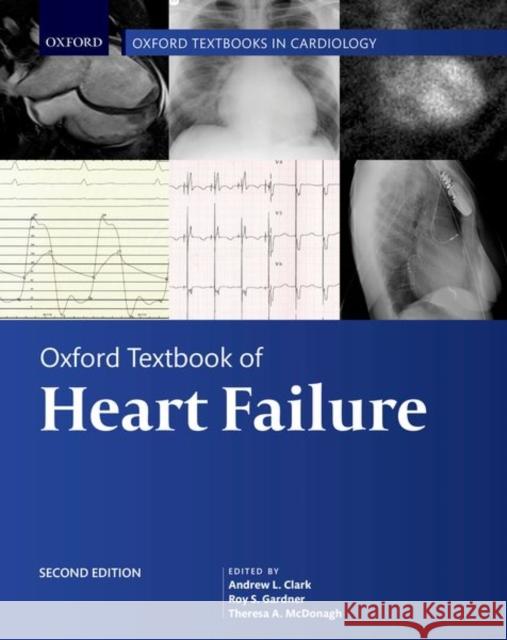 Oxford Textbook of Heart Failure Clark, Andrew L. 9780198766223 Oxford University Press