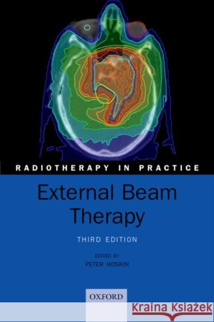 External Beam Therapy Peter Hoskin 9780198786757 Oxford University Press, USA