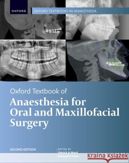 Oxford Textbook of Anaesthesia for Oral and Maxillofacial Surgery, Second Edition Michael G. (Daniel CK Yu Professor, Daniel CK Yu Professor, Dept of Anaesthesiology University of Hong Kong) Irwin 9780198790723