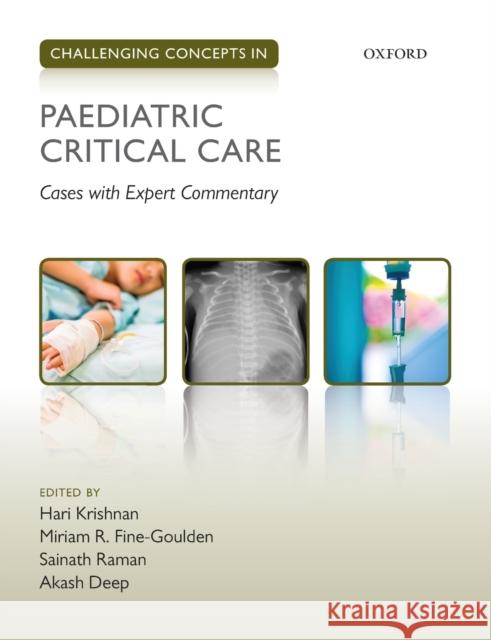 Challenging Concepts in Paediatric Critical Care: Cases with Expert Commentary Hari Krishnan Miriam R. Fine-Goulden Sainath Raman 9780198794592 Oxford University Press, USA