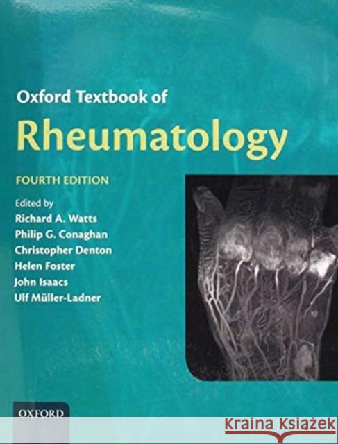 Oxford Textbook of Rheumatology Richard A. Watts (University of East Ang Philip G. Conaghan (University of Leeds  Christopher Denton (University College 9780198797326 Oxford University Press