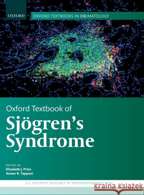 Oxford Textbook of Sjögren's Syndrome Price, Elizabeth J. 9780198806684