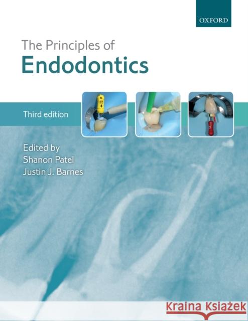 The Principles of Endodontics Shanon Patel Justin J. Barnes 9780198812074 Oxford University Press, USA