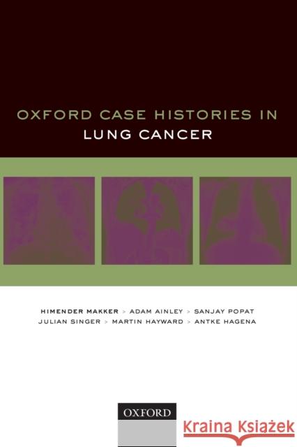 Oxford Case Histories in Lung Cancer Himender K. Makker Adam Ainley Sanjay Popat 9780198813033 Oxford University Press, USA