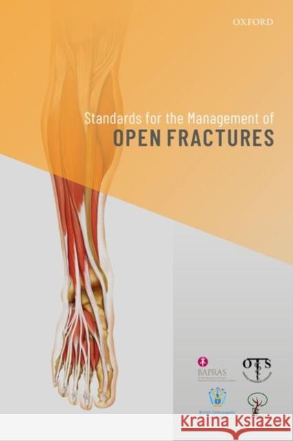 Standards for the Management of Open Fractures Simon Eccles Bob Handley Umraz Khan 9780198849360