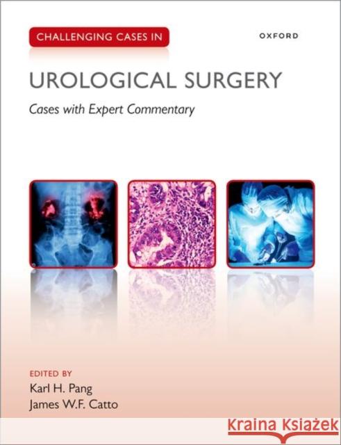 Challenging Cases in Urological Surgery KARL H. PANG 9780198854371