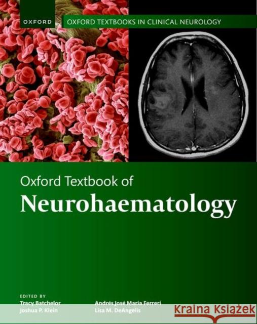 Oxford Textbook of Neurohaematology  9780198884903 Oxford University Press