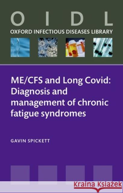 Chronic Fatigue Gavin (Retired consultant in Immunology, Allergy, and General Medicine, Retired consultant in Immunology, Allergy, and G 9780198962137 Oxford University Press