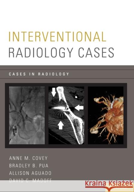 Interventional Radiology Cases Anne M. Covey Bradley Pua Allison Aguado 9780199331277