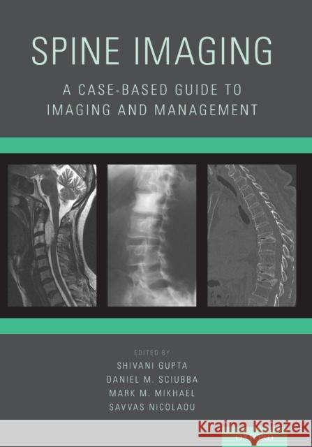 Spine Imaging: A Case-Based Guide to Imaging and Management Shivani Gupta Daniel M. Sciubba Mark M. Mikhael 9780199393947 Oxford University Press, USA