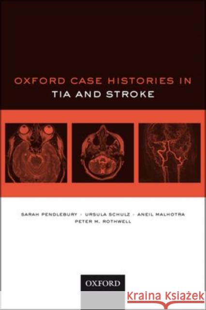 Oxford Case Histories in Stroke Pendlebury, Sarah T. 9780199539345 0