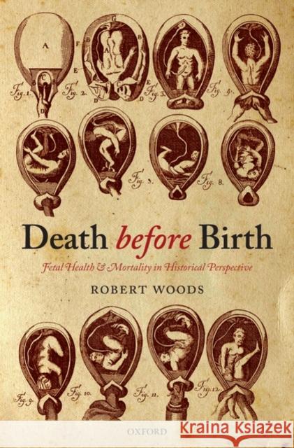 Death Before Birth: Fetal Health and Mortality in Historical Perspective Woods, Robert 9780199542758 Oxford University Press, USA