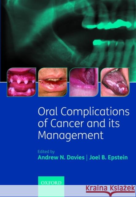 Oral Complications of Cancer and Its Management Davies, Andrew 9780199543588