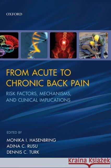 From Acute to Chronic Back Pain: Risk Factors, Mechanisms, and Clinical Implications Hasenbring, Monika I. 9780199558902 0