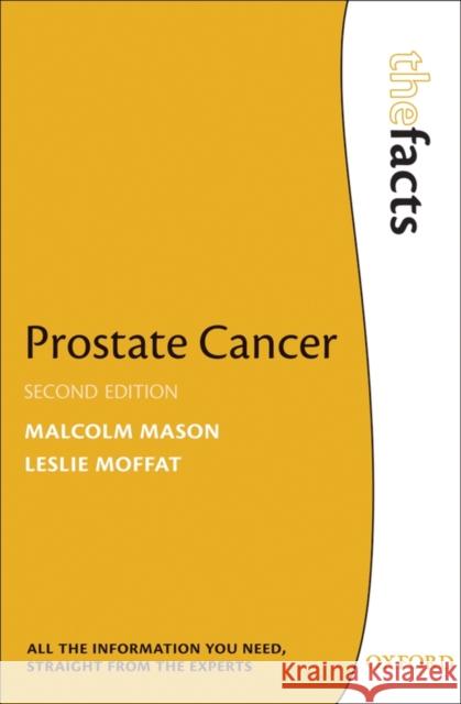 Prostate Cancer Malcolm Mason 9780199573936