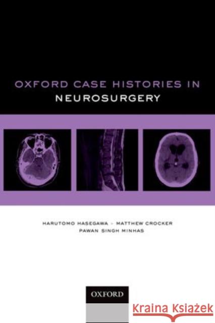 Oxford Case Histories in Neurosurgery Harutomo Hasegawa 9780199599837 Oxford University Press