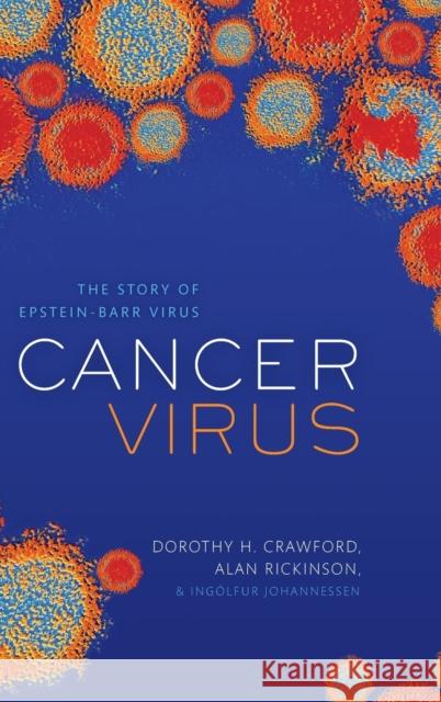 Cancer Virus: The story of Epstein-Barr Virus Ingolfur (Consultant medical virologist and senior lecturer, Consultant medical virologist and senior lecturer, Royal In 9780199653119 Oxford University Press