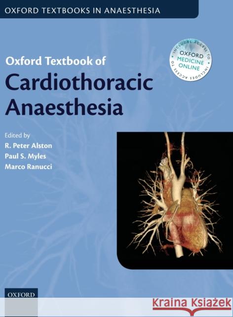Oxford Textbook of Cardiothoracic Anaesthesia Marco Ranucci R. Peter Alston Paul S. Myles 9780199653478 Oxford University Press, USA