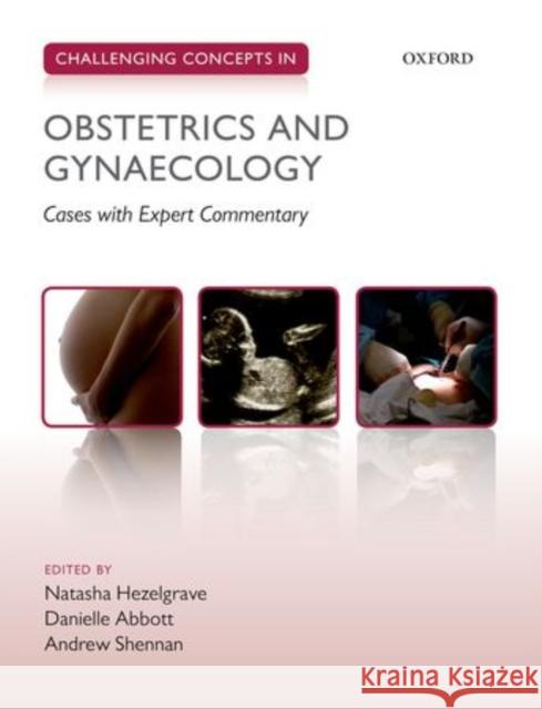 Challenging Concepts in Obstetrics and Gynaecology: Cases with Expert Commentary Natasha Hezelgrave 9780199654994 OXFORD UNIVERSITY PRESS ACADEM